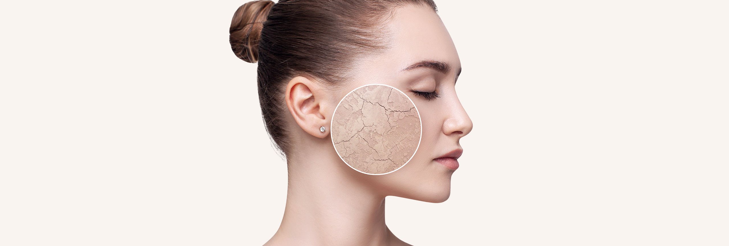 Persona con piel seca