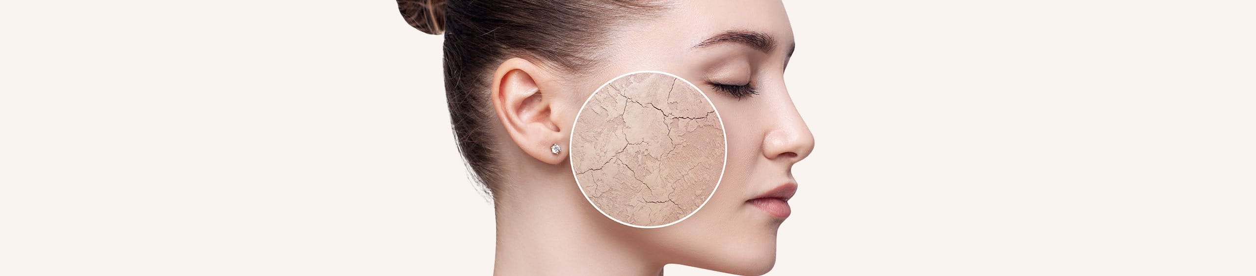 Persona con piel seca