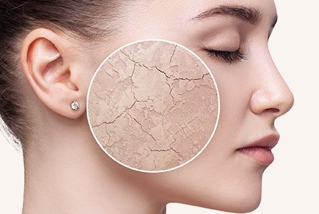 Persona con piel seca