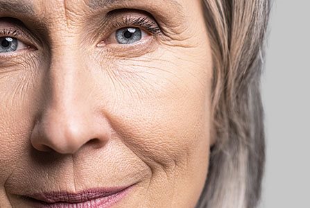 Mujer con arrugas en el rostro
