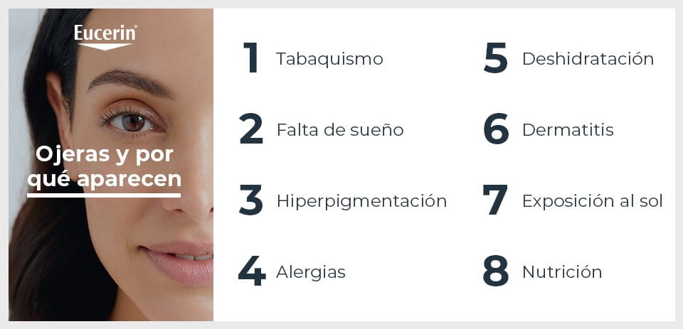 Causas de las ojeras