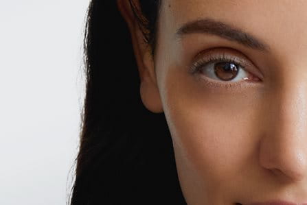 ¿Qué son las ojeras?