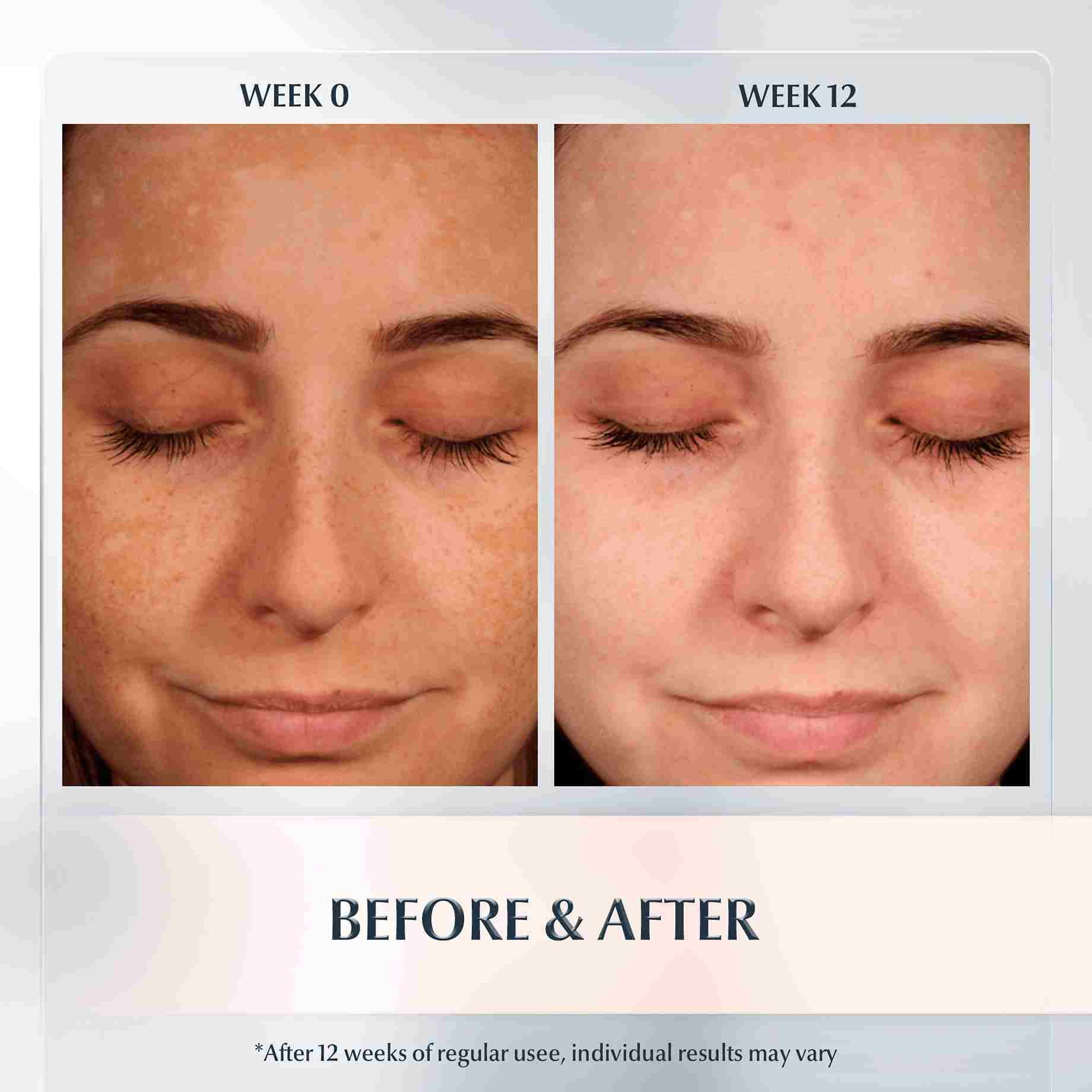 Before and after results Spotless Brightening Day Fluid