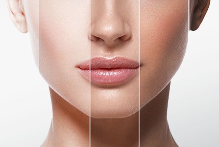 ¿Cuáles son los distintos tipos de piel?