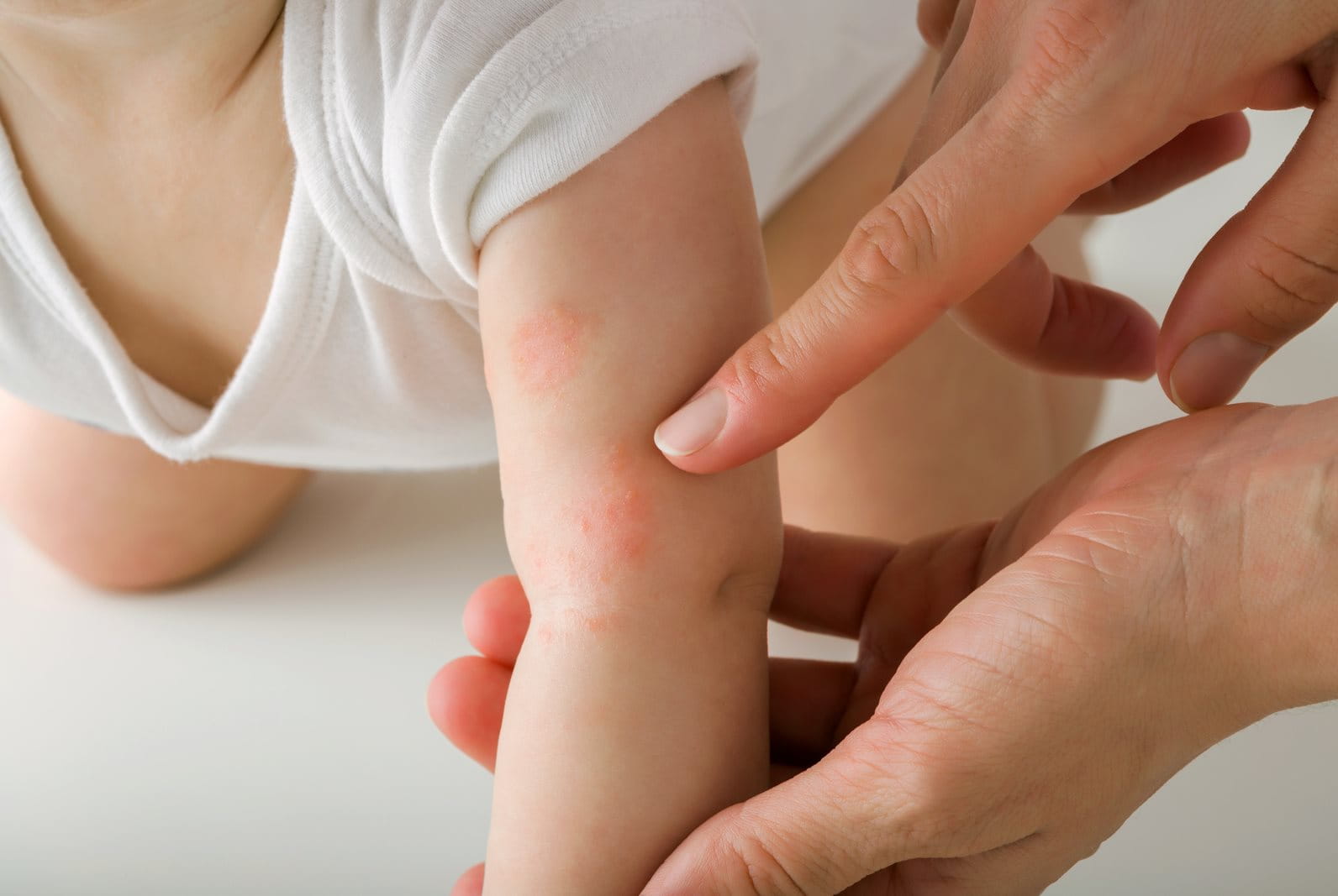 Baby skin