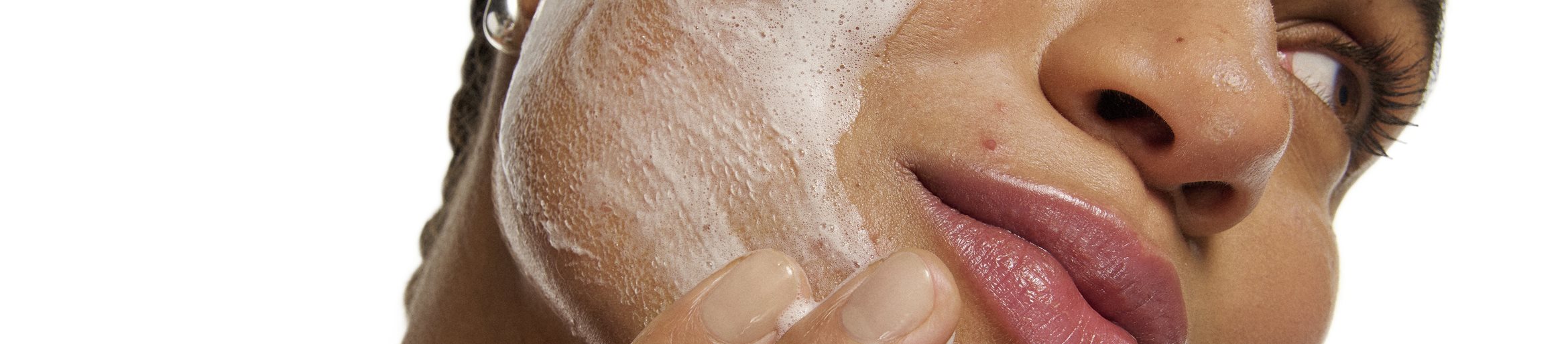 acne-factores-contribuyentes -tratamientos-soluciones