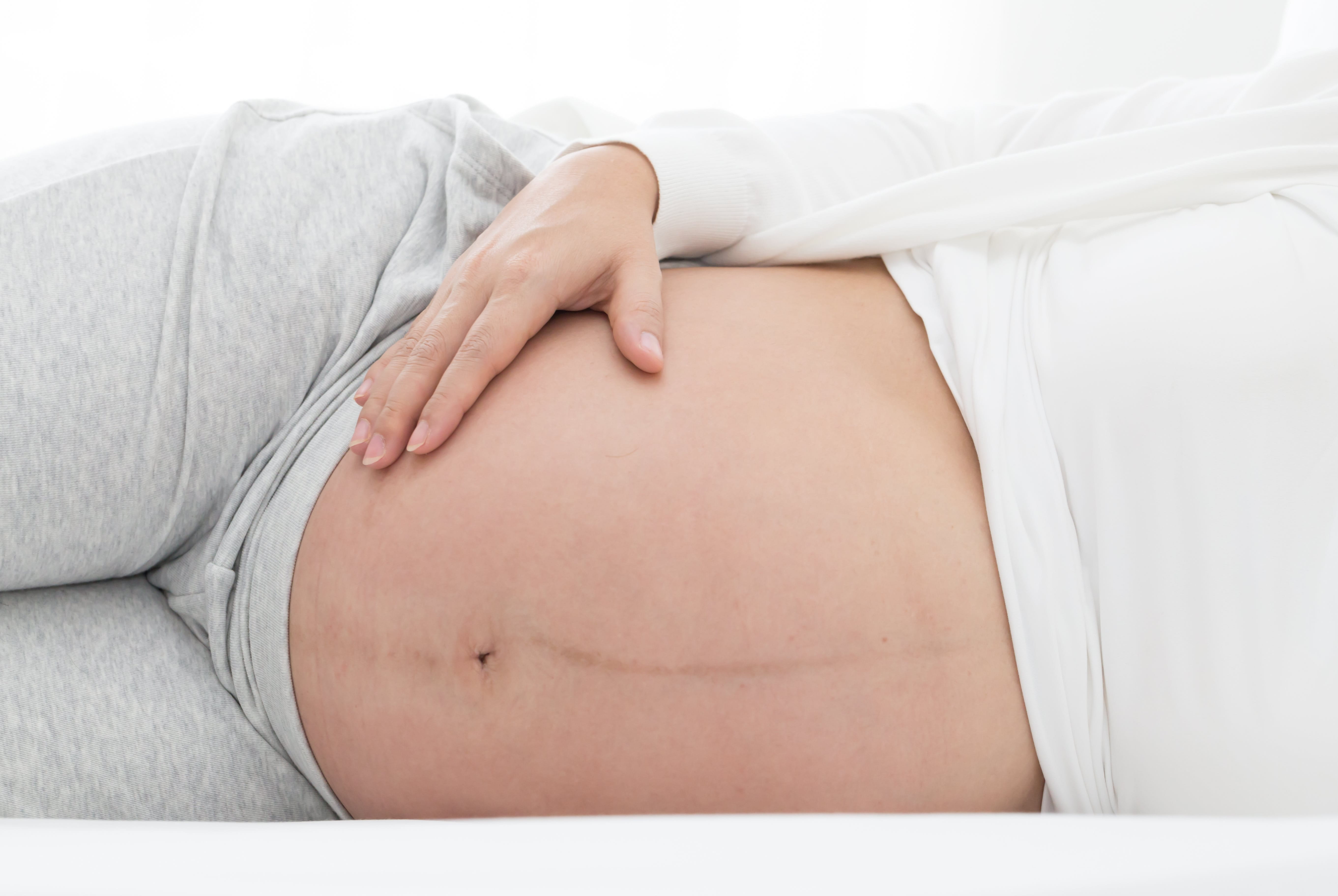 Dunkle Linie auf dem Bauch einer auf der Seite liegenden schwangeren Frau