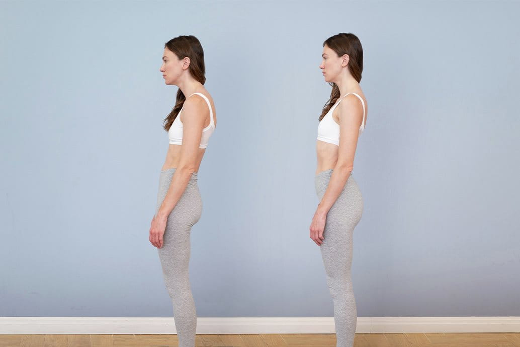 foto ragazza doppio mento postura scorretta