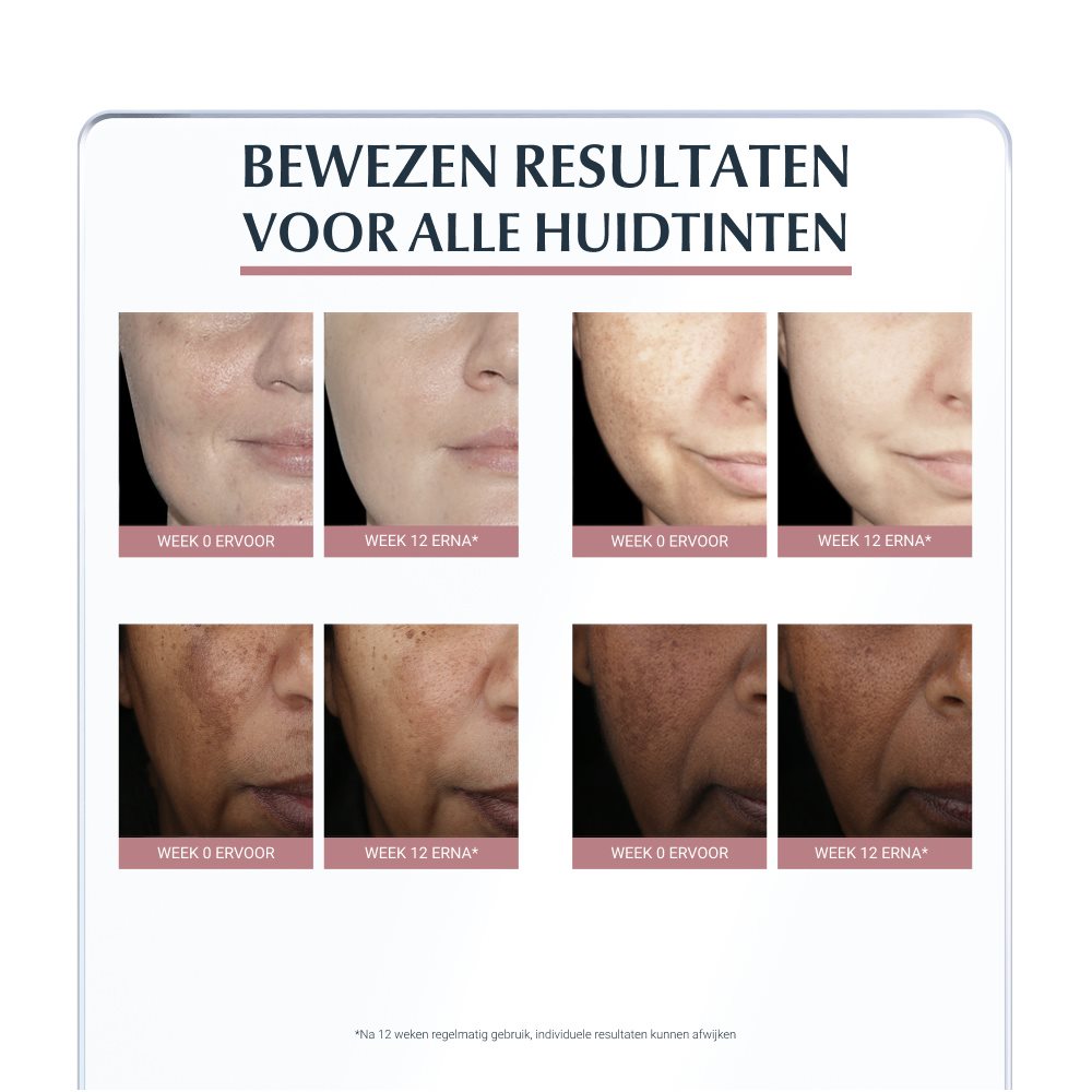 Sauvasine kurkuma serum - Corrigeer donkere vlekken en voed de huid