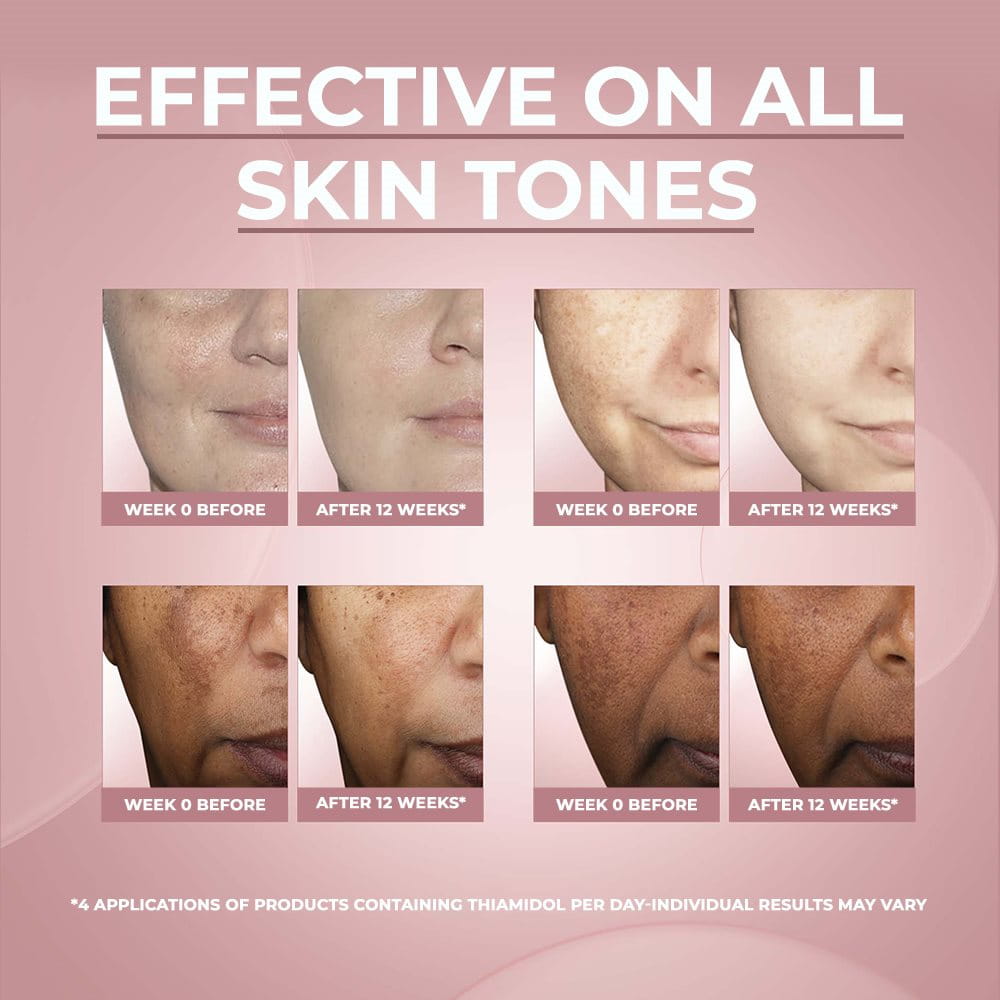 Eucerin Effects On Skin Before After
