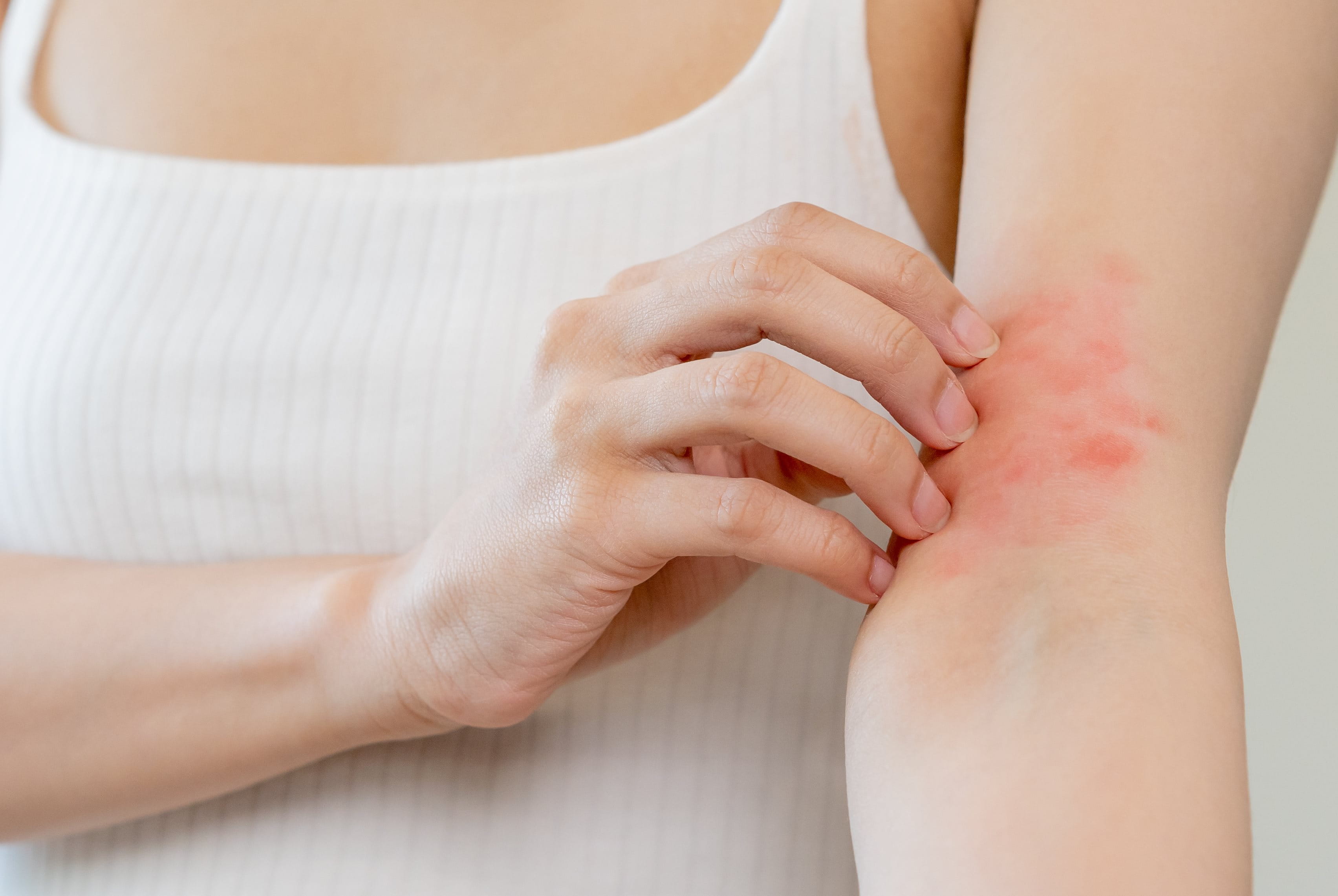 Stress kan de natuurlijke balans van de huid verstoren en ontstekingsreacties verergeren.