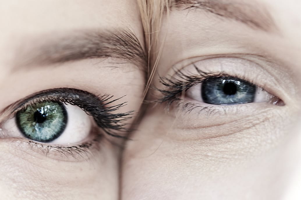 biorivitalizzazione occhiaie