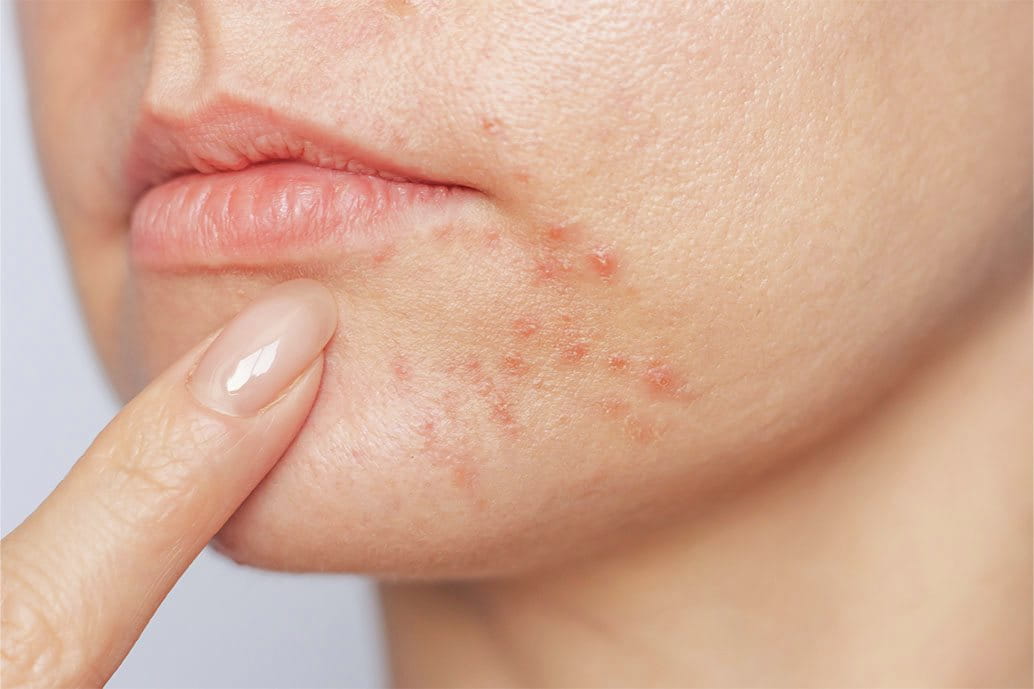 prodotti Eucerin linea anti-age