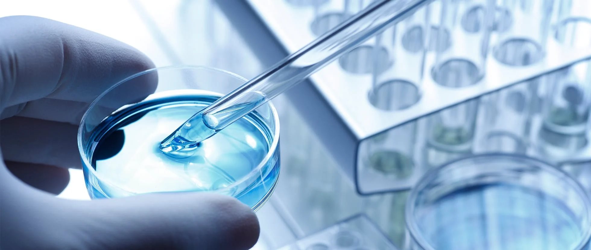 Im Labor wird eine Flüssigkeit mit einer Pipette aufgenommen 