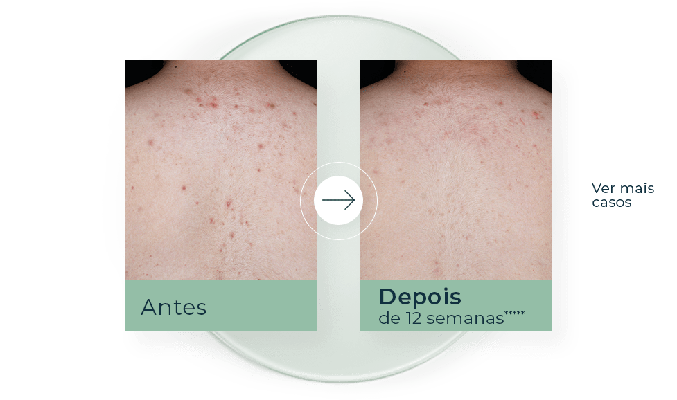 histórias de sucesso