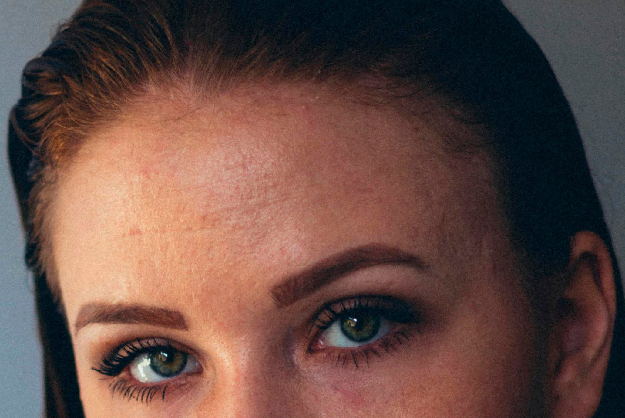 que-es-el-acido-hialuronico-como-actua-frente-a-las-arrugas