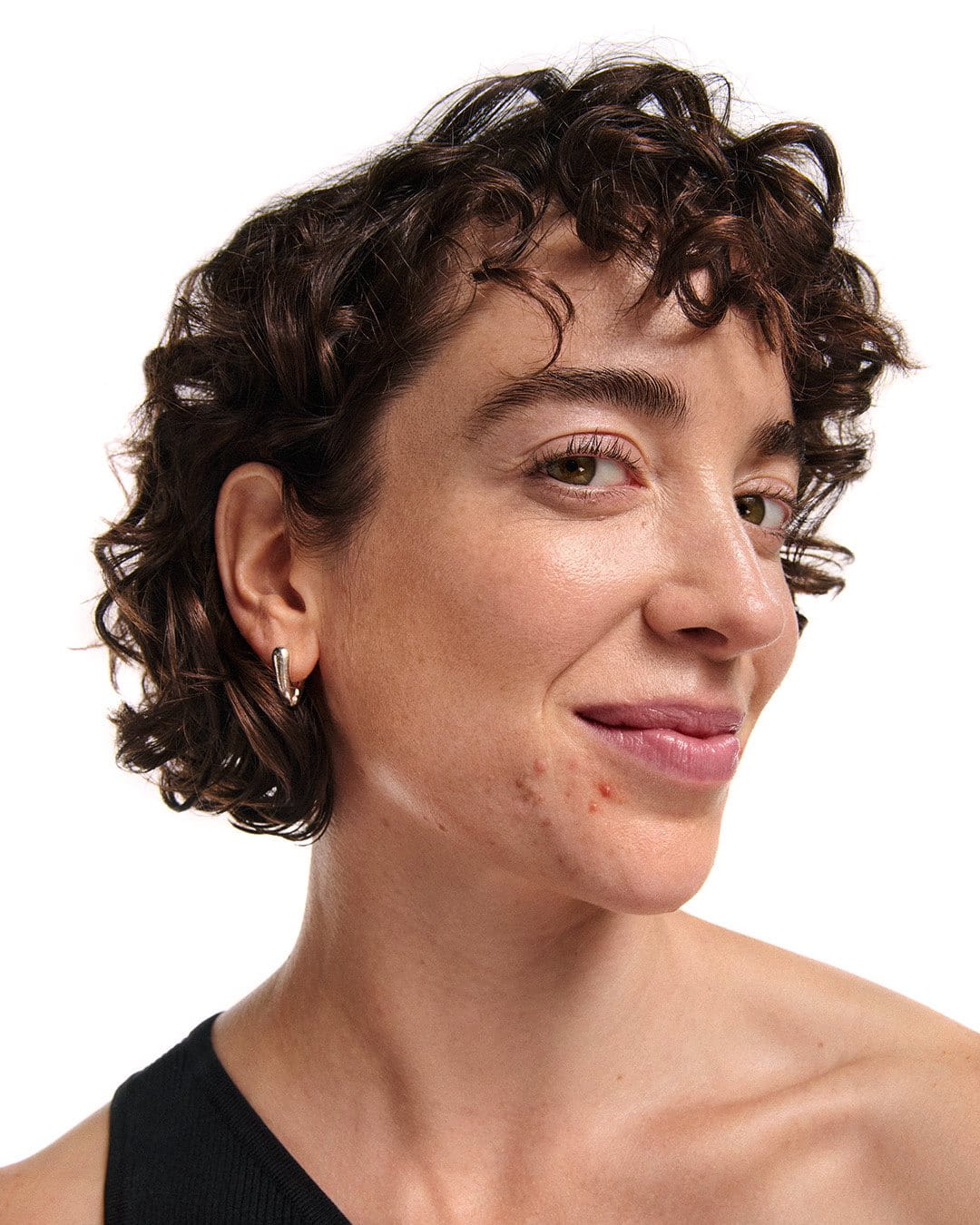 como-afectan-las-hormonas-a-la-piel-acne