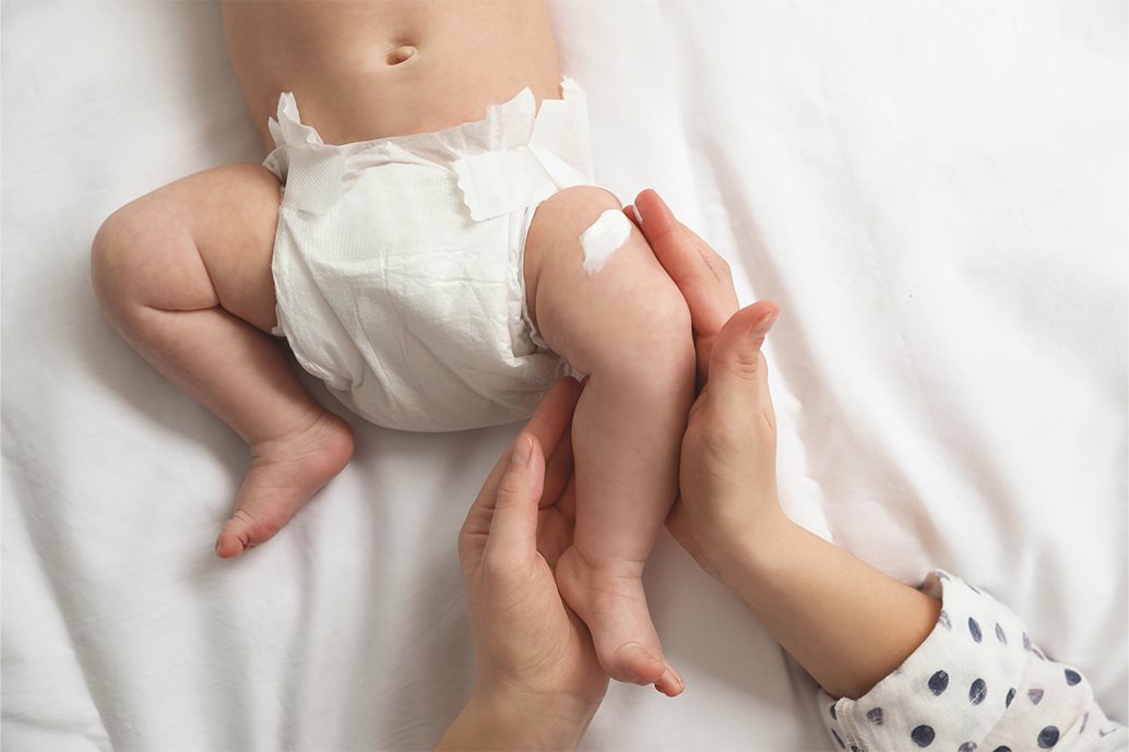 pelle secca neonato gambe