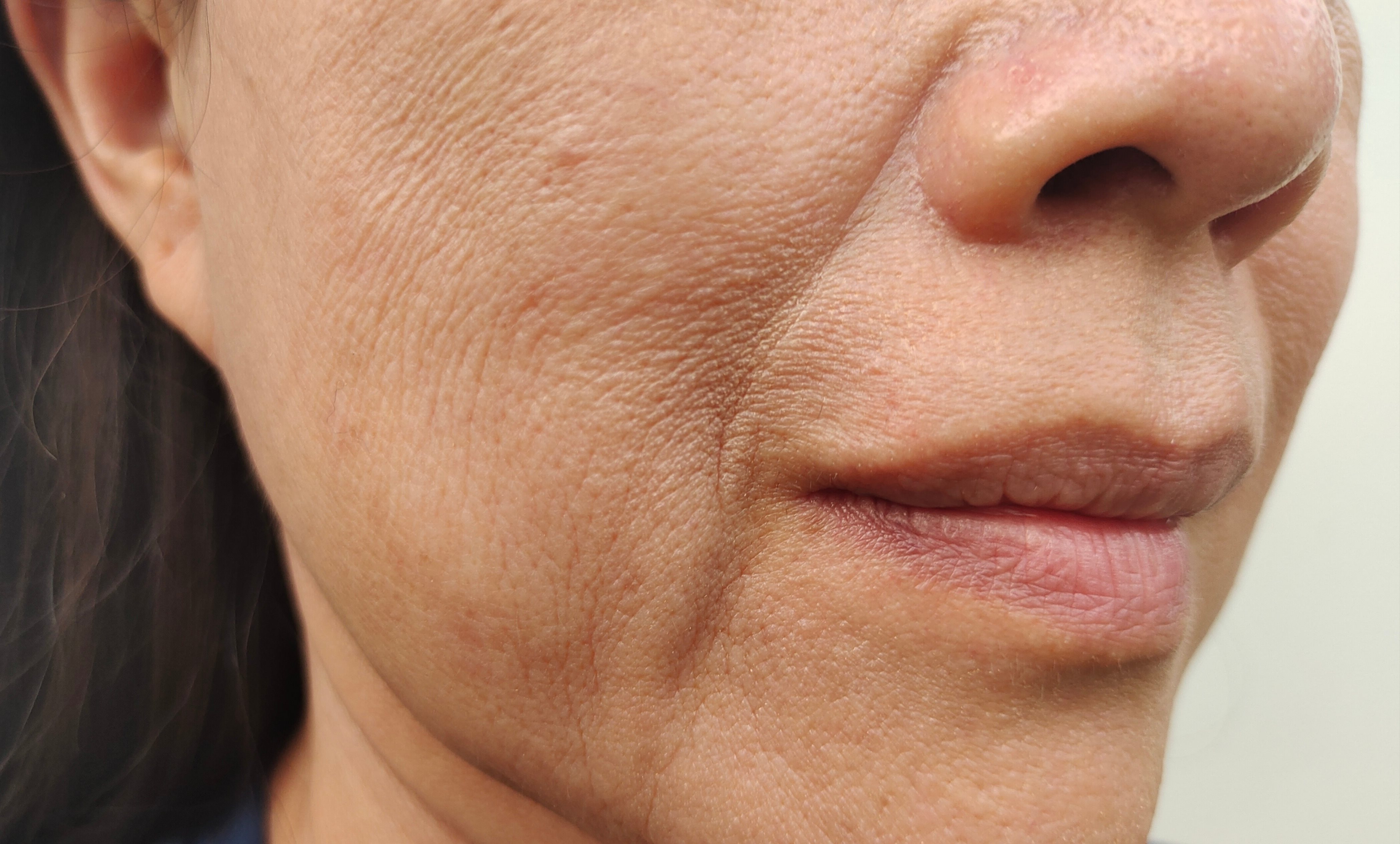 Gros plan sur la partie inférieure du visage d'un adulte avec la texture de la peau bien visible, des ridules, des rides légères et une peau fine bien visibles.