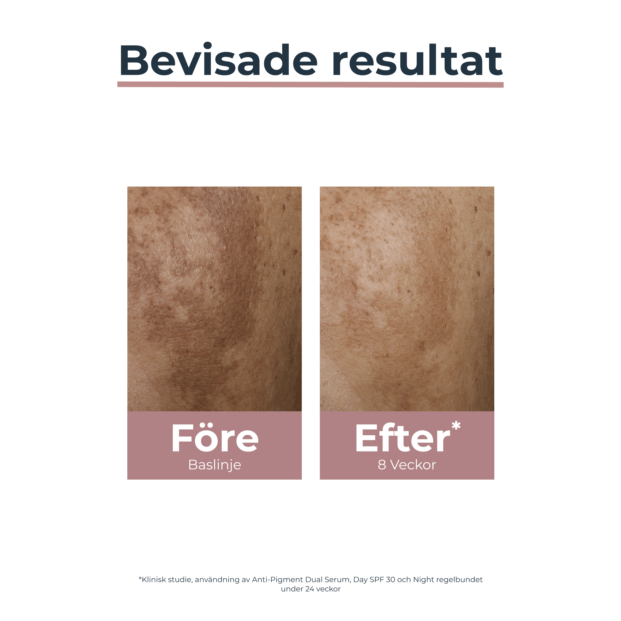 A study result of before and after using Eucerin Anti Pigment Day Cream SPF30