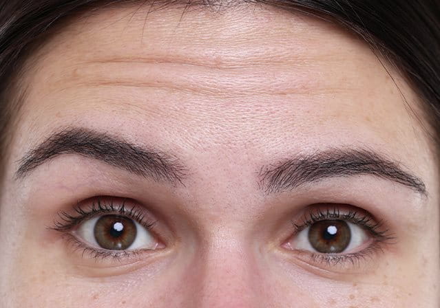 Primo piano di donna con rughe sottili sulla fronte