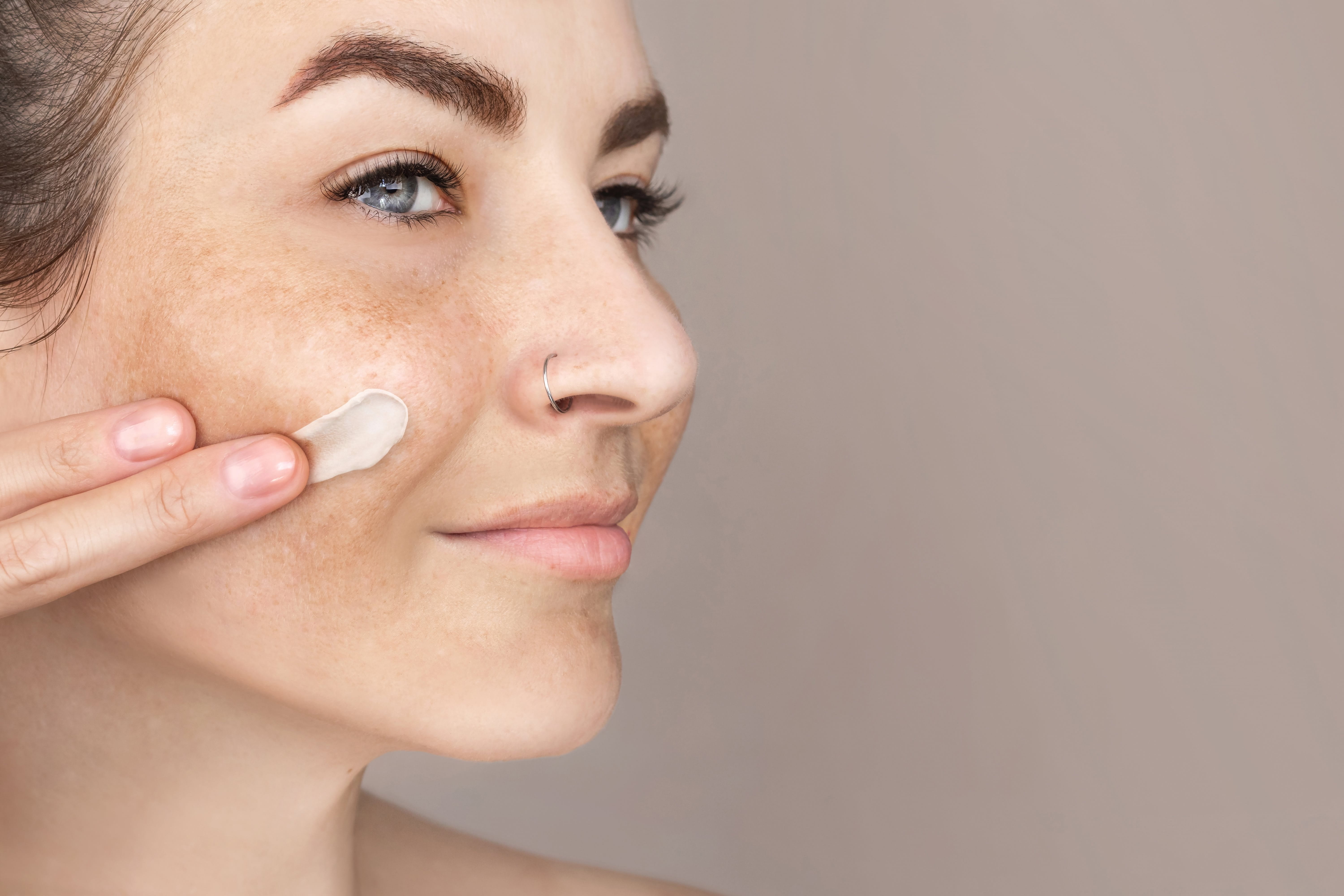 Seitenansicht des Gesichts einer jungen Frau. Sie trägt Creme auf ihre Wange auf, die ein Melasma zeigt