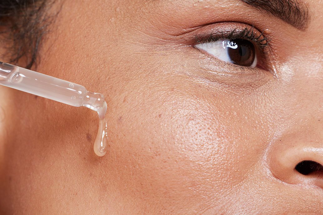 Donna applica siero con acido salicilico su guancia, tramite pipetta, per trattare la pelle a tendenza impura