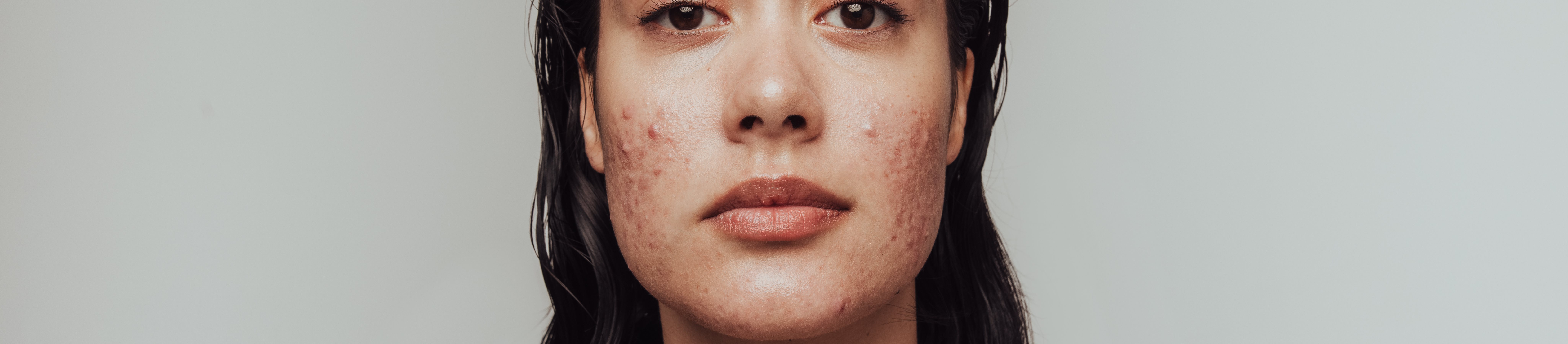 Een persoon met lang, donker haar poseert tegen een neutrale achtergrond, waarbij de blote schouders en sleutelbeenderen zichtbaar zijn.