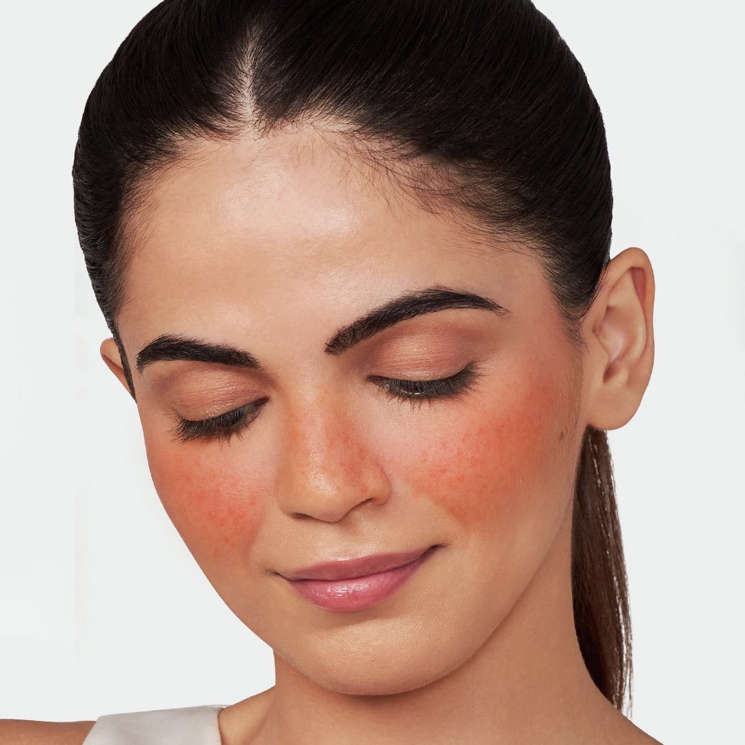 Facial redness inflammation skin treatment