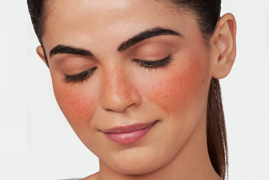 kuva punaposkista naisesta, joka katsoo alas