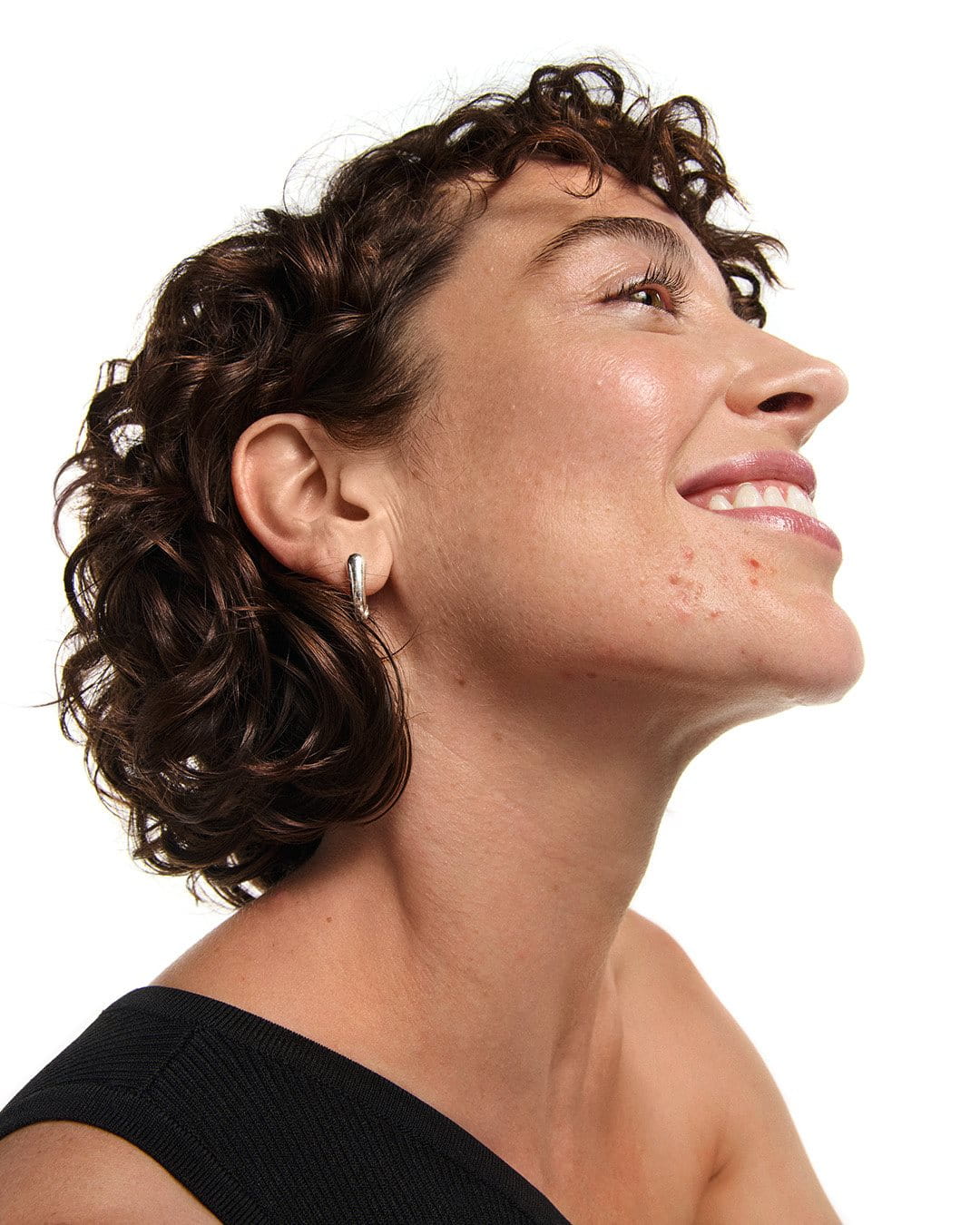 a woman with acne prone skin