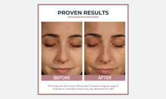 A solution for more even skin.