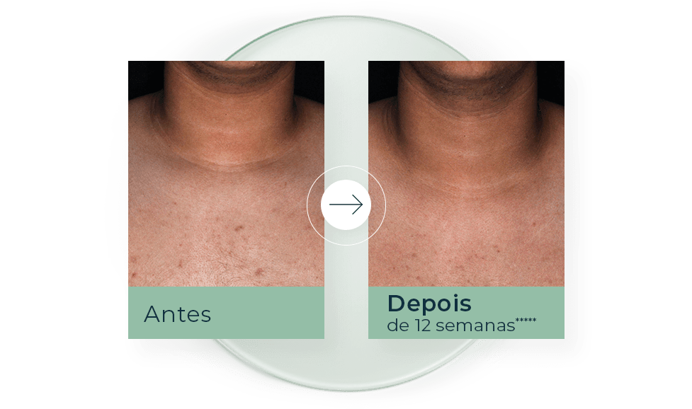 histórias de sucesso