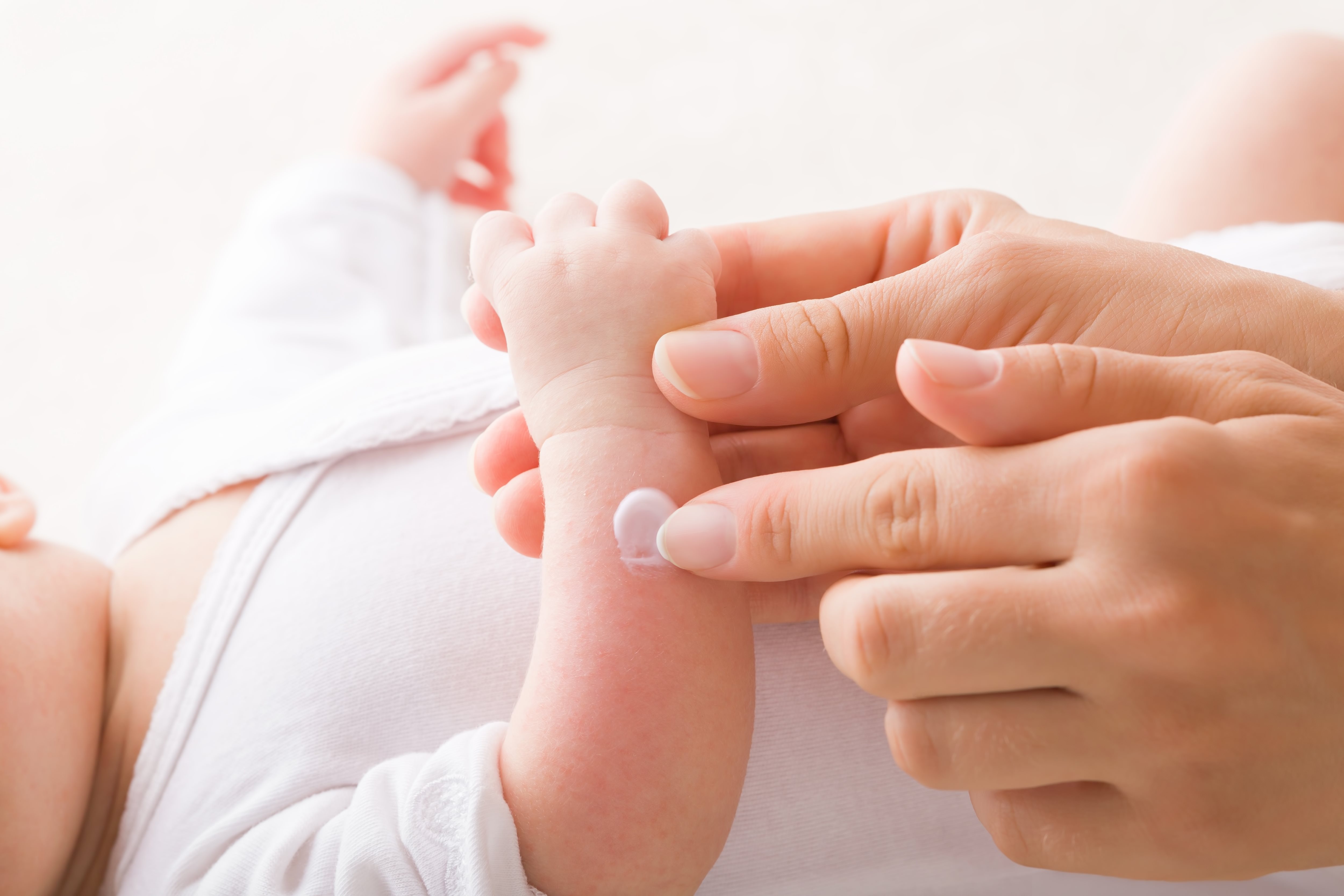 Der Arm eines Babys wird mit einer Lotion eingecremt.