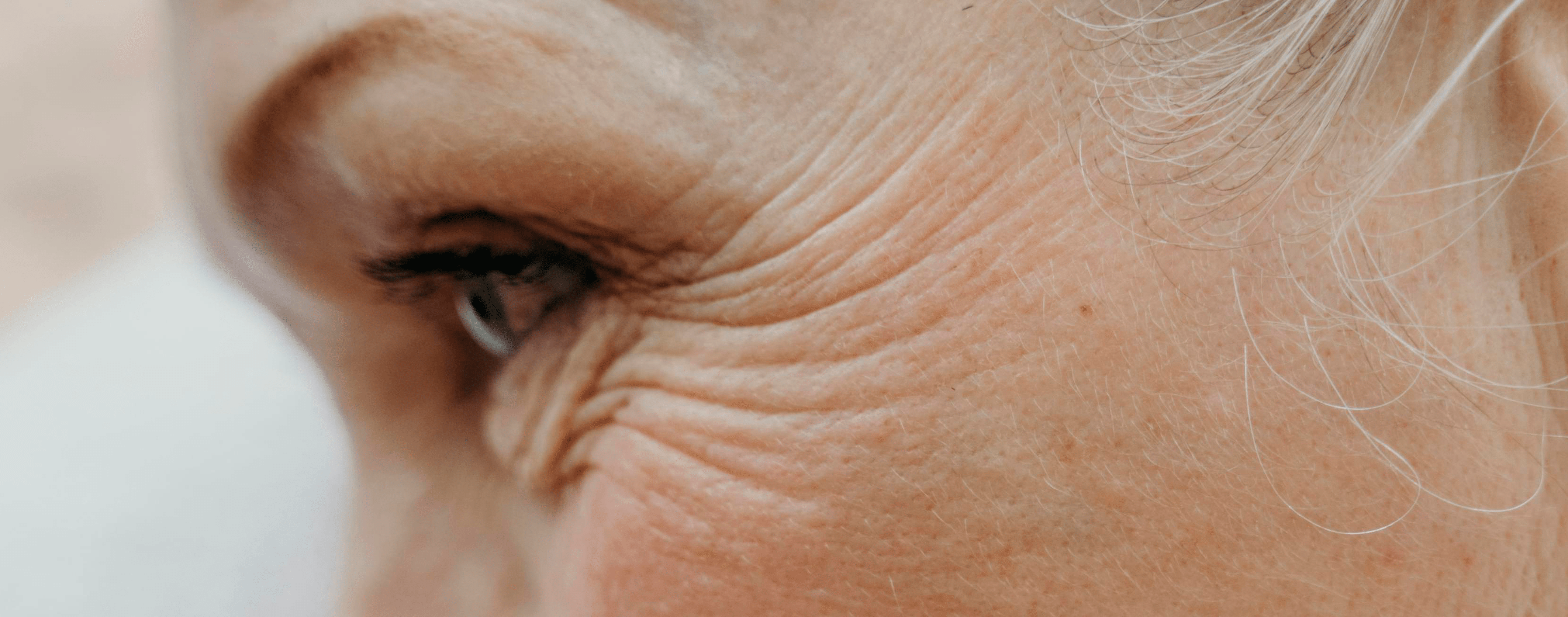 que-es-el-colageno-como-actua-contra-las-arrugas-eucerin