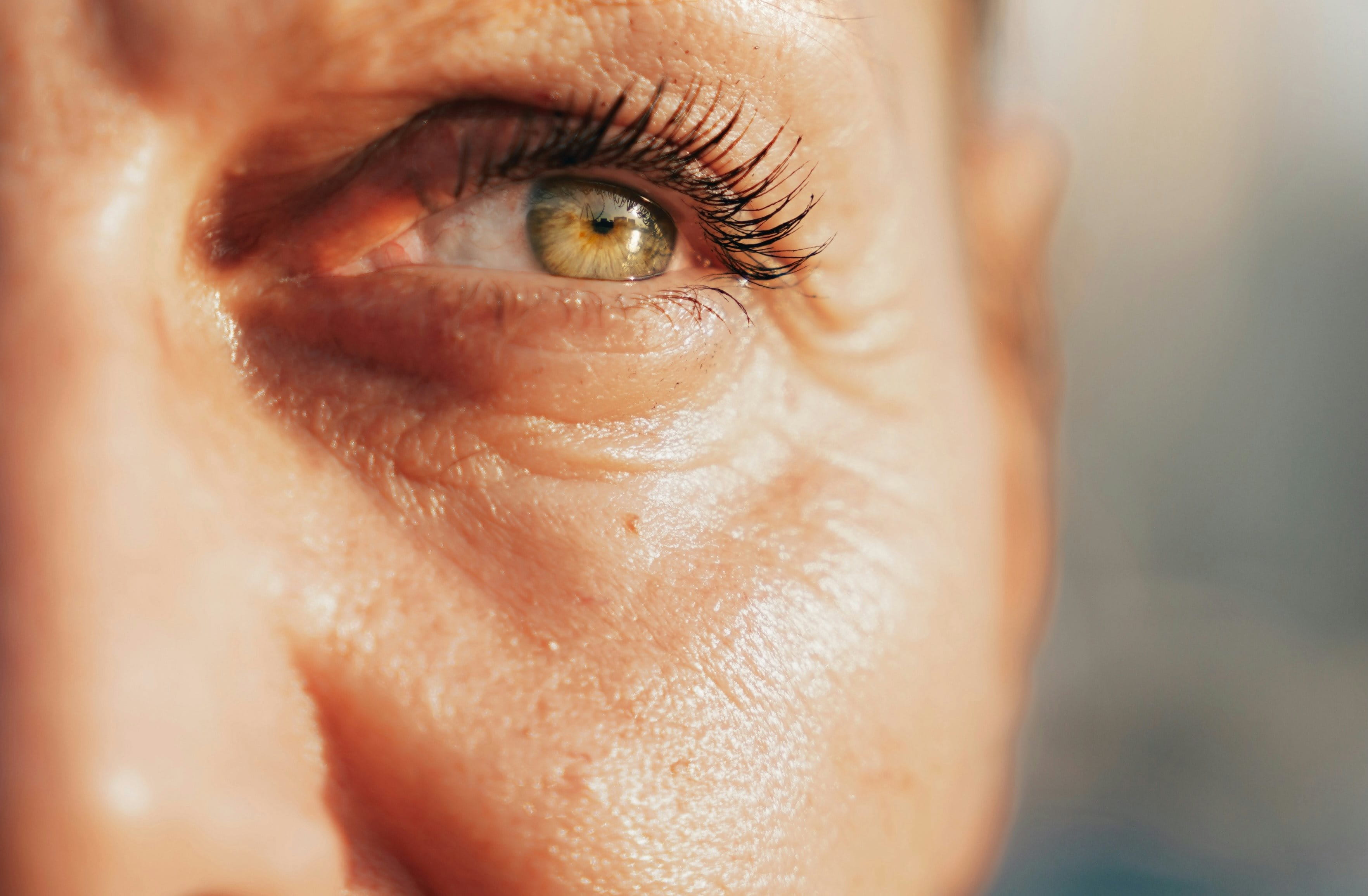 Nahaufnahme der rechten Gesichtshälfte einer Frau mit heller Haut, die in der Sonne steht. Ihre dünner werdende Haut zeigt feine Linien und Falten.