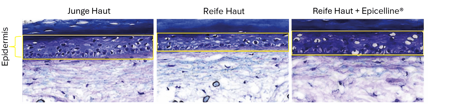 3D-Hautalterungsmodell der Epidermis in verschiedenen Stadien: links junge Haut, mittig reife Haut, rechts reife Haut nach Behandlung mit Epicelline®