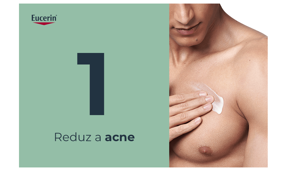 Reduz a acne