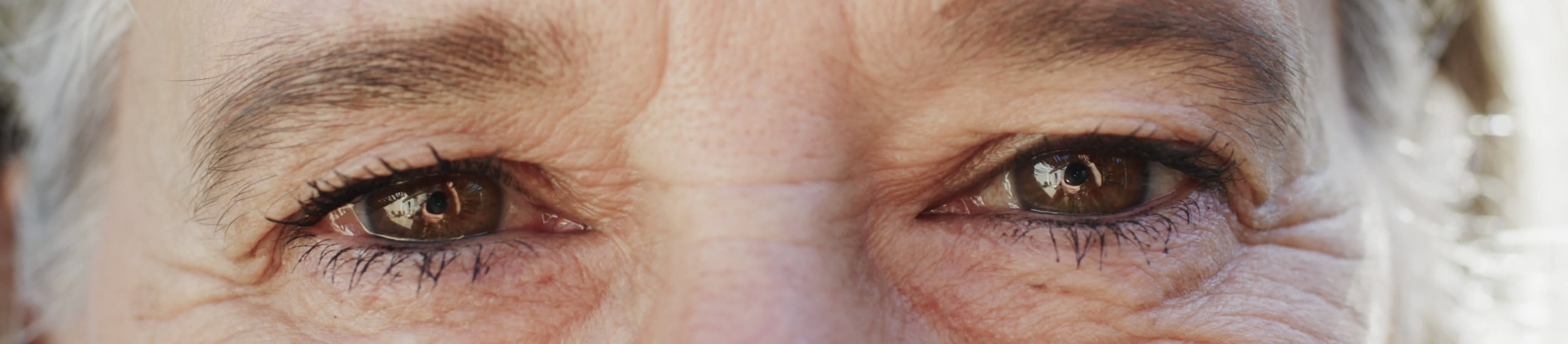 lähikuva naisen otsasta