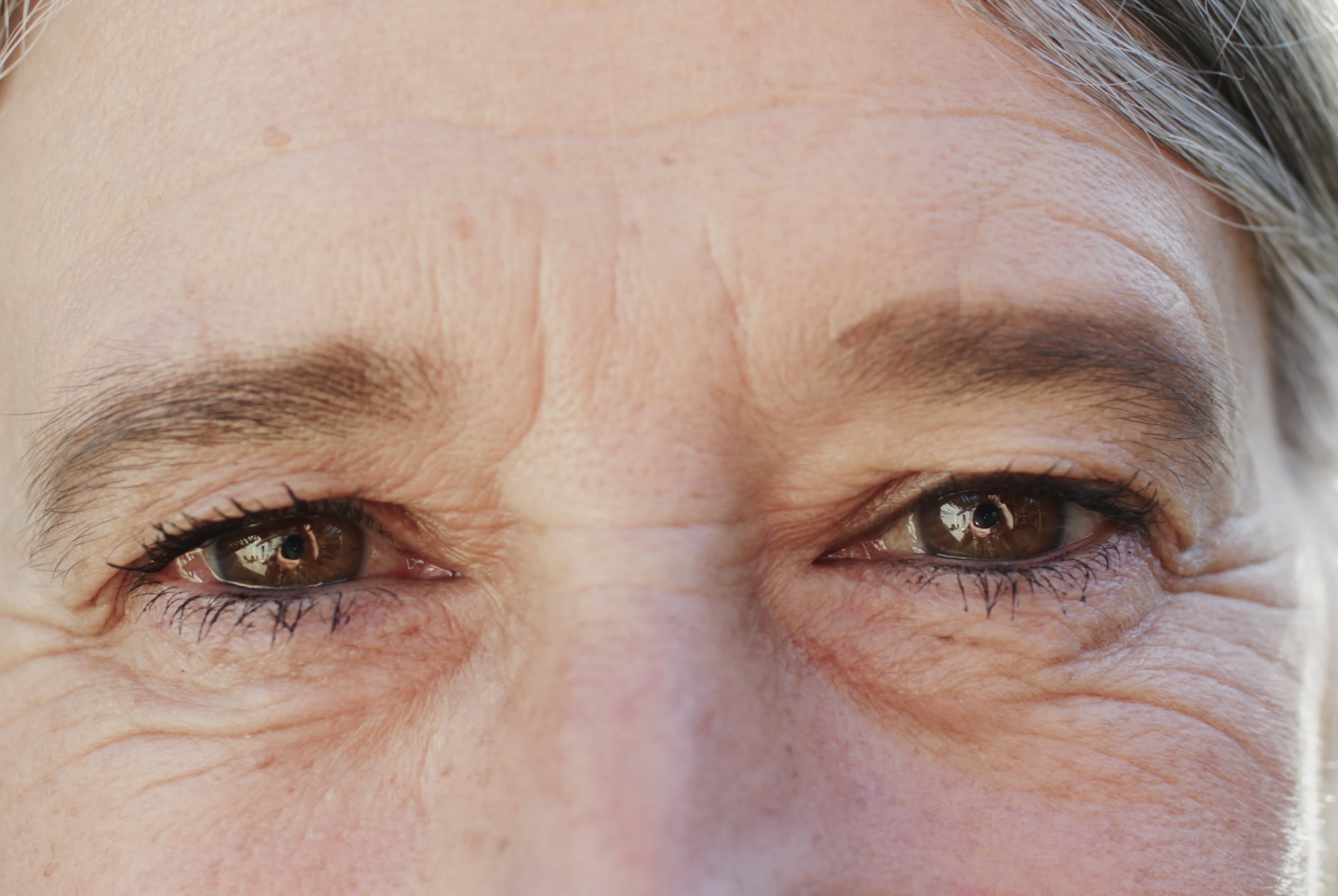 lähikuva naisen otsasta