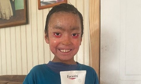 ENCOUNTER / PSORIASIS Project in Germany