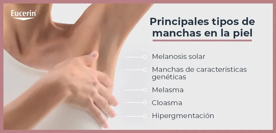 Tipos de manchas na pele