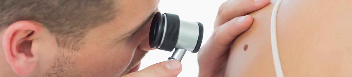 cheratoacantoma: immagine di visita per intervento asportazione cheratoacantoma