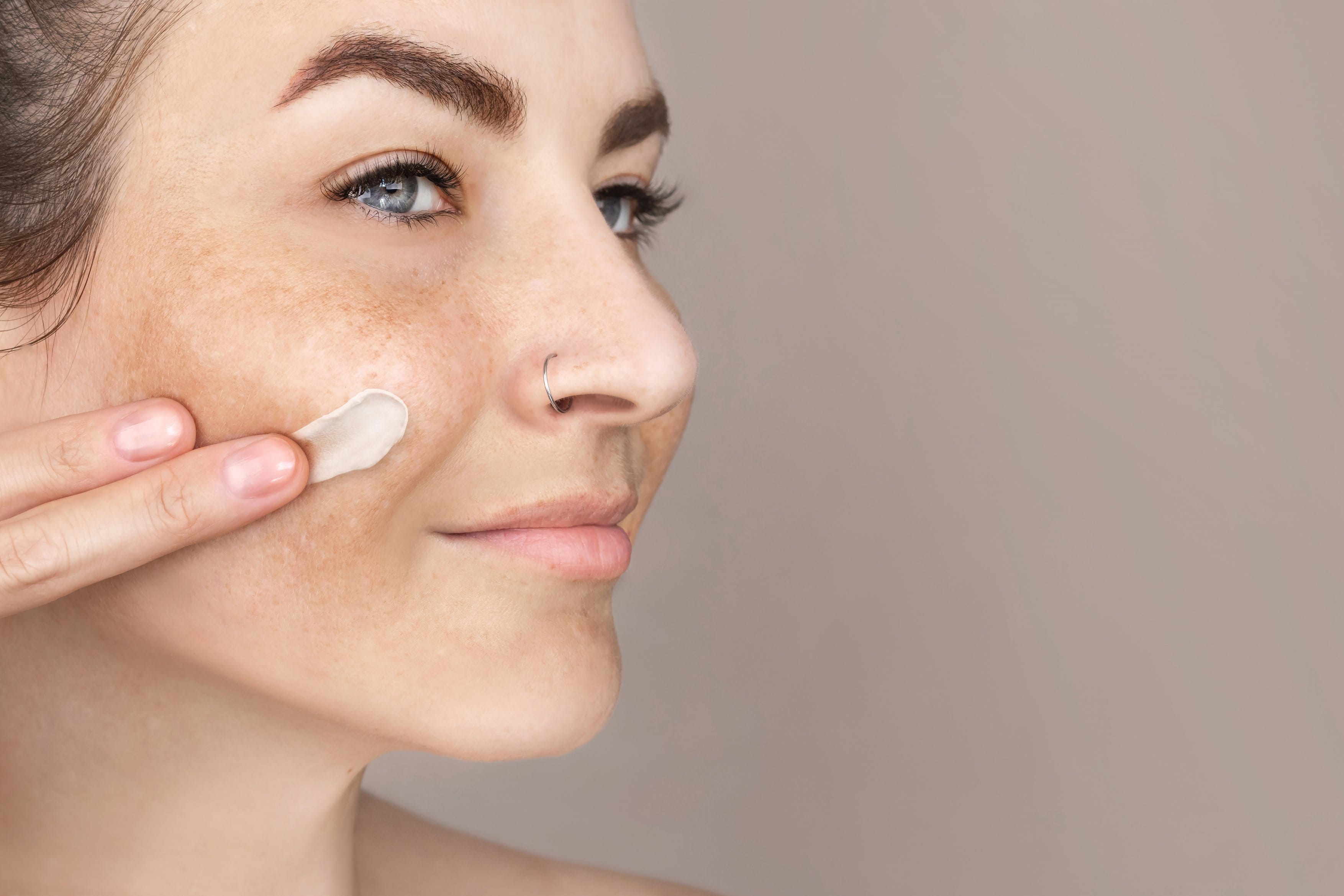 Nahaufnahme des Gesichtshälfte einer Frau mit Pigmentflecken und Melasma.