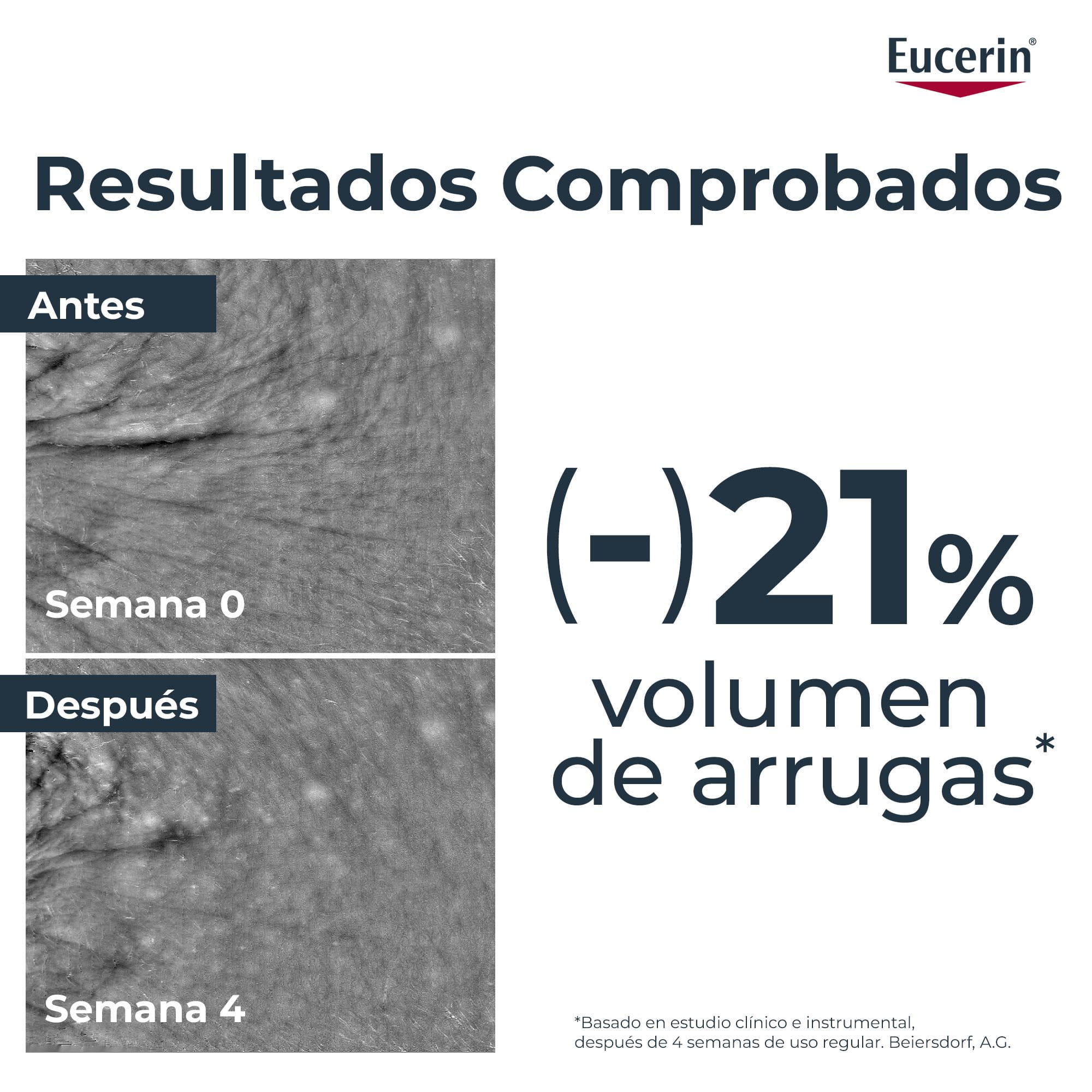 Sérum epigenético clínicamente comprobado para reducir los pliegues.