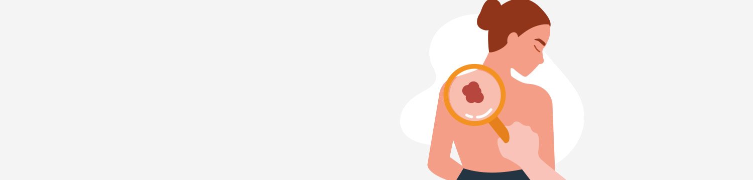 kontrola znamének na těle