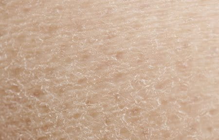 uvećana slika pora suhe kože