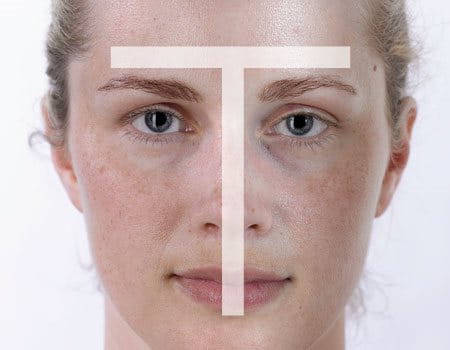 ansiktsbild av kvinna med illustrerad T-zon som indikerar feta partier för blandhy