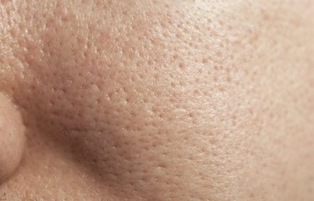 Close-up from cheek with enlarged pores