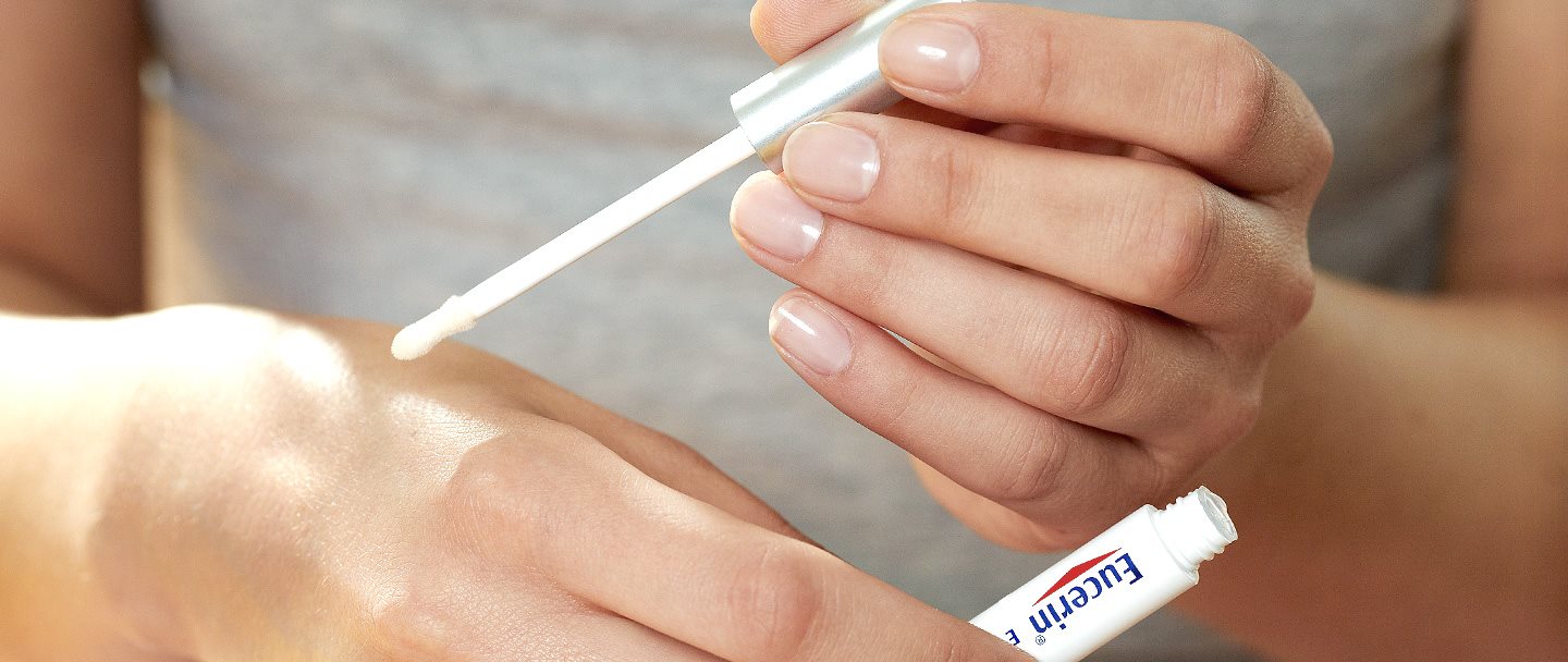 Altersflecken loswerden